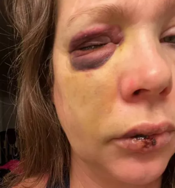 Help Holly Recover