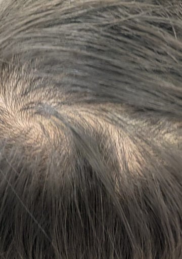 A balding guy