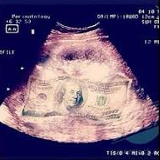 Ultrasound Money
